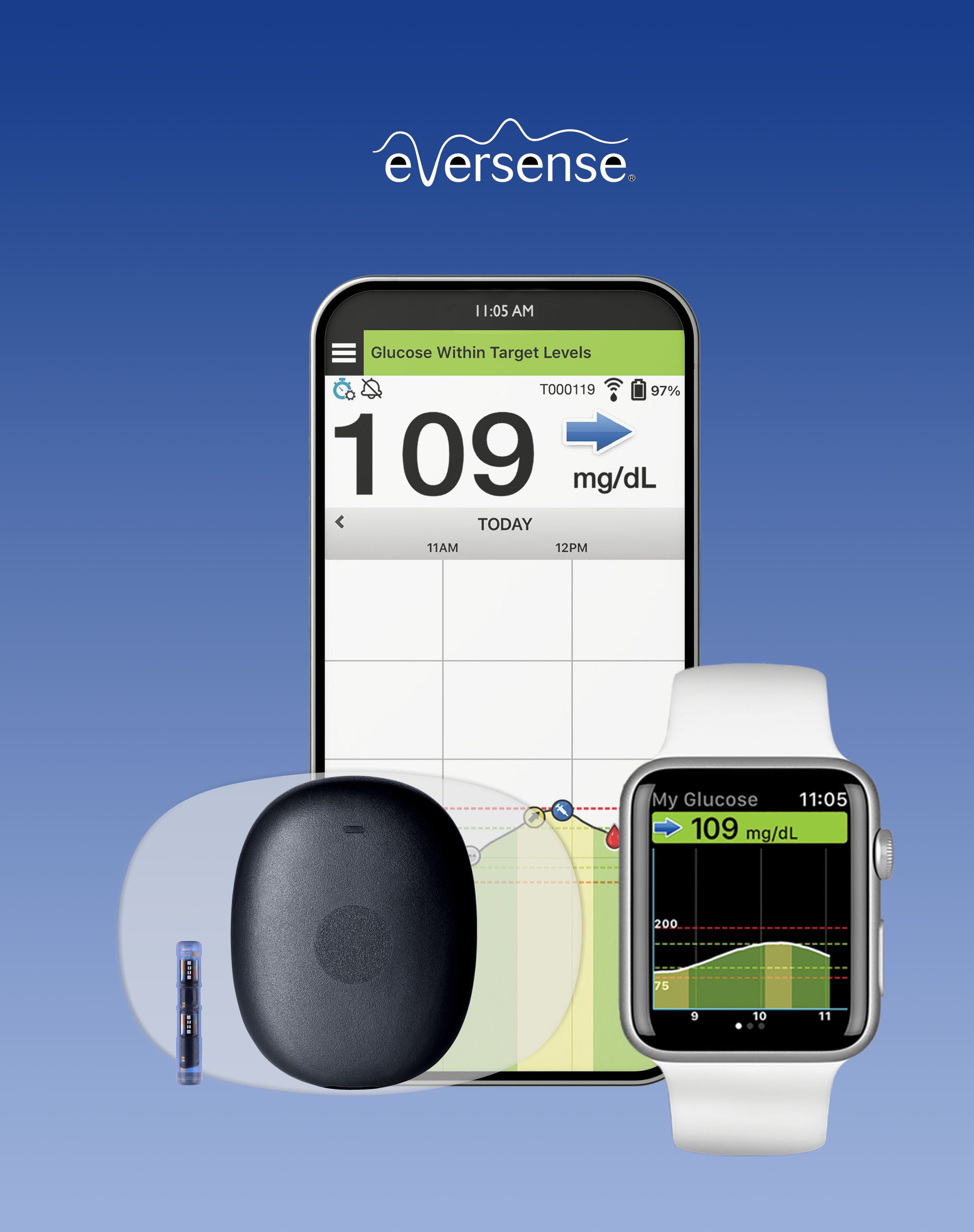 Eversense E3